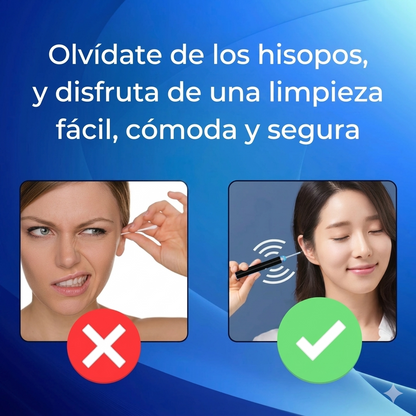 Limpiador de Oídos con Cámara HD hisocam™